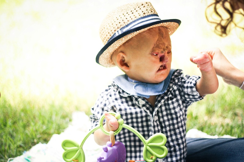 Αυτό το μωράκι δεν έχει πρόσωπο - Ποια ήταν η τύχη του; - Media