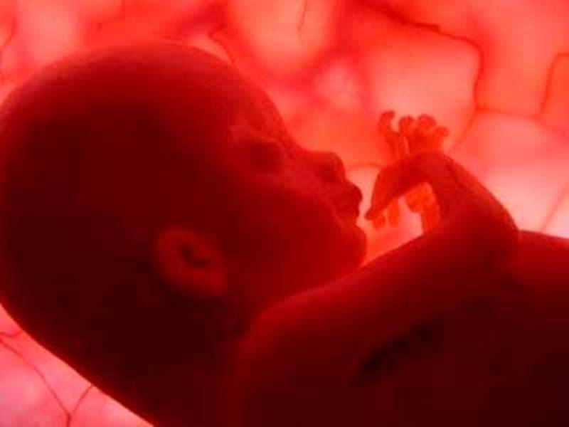 Νέο τεστ DNA μπορεί να εντοπίσει πότε ένα έμβρυο έχει σύνδρομο Down - Media