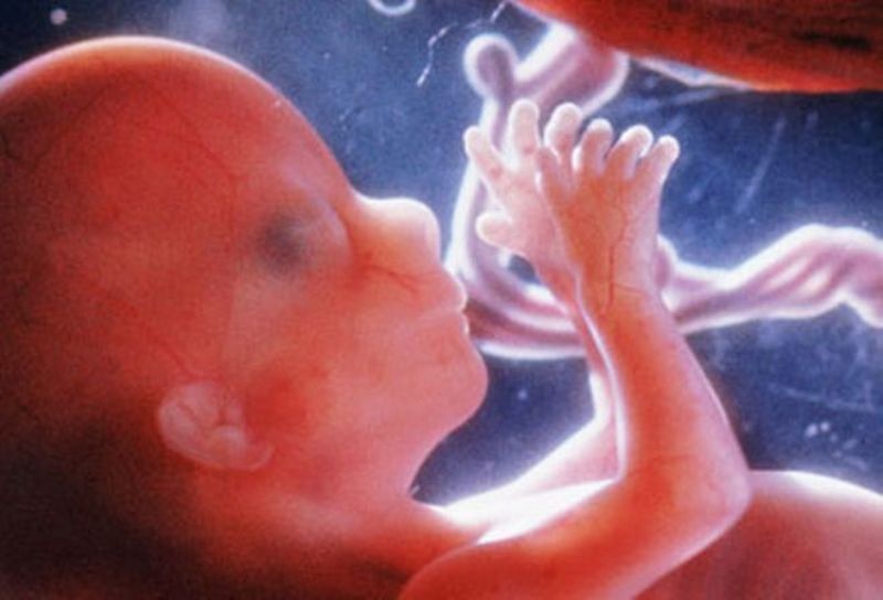 Μαγνητική τομογραφία σταθμός για τις εγκύους - Αποτυπώνει λεπτομέρειες εμβρύων 20 εβδομάδων (Photos-Video)  - Media