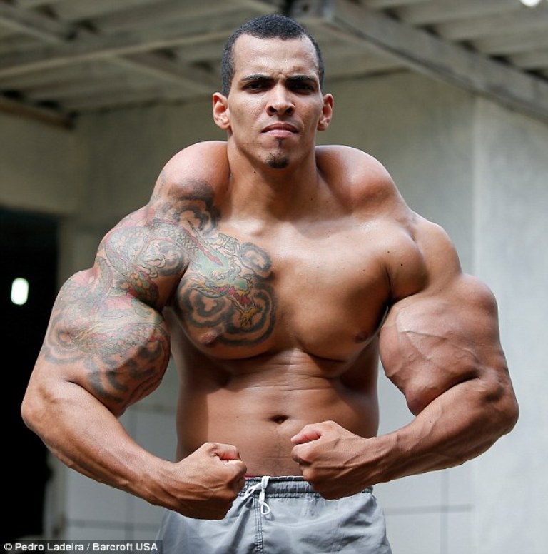 Κάνει ενέσεις με λάδι και αλκοόλ στους μύες του για να γίνει Hulk (Photos) - Media