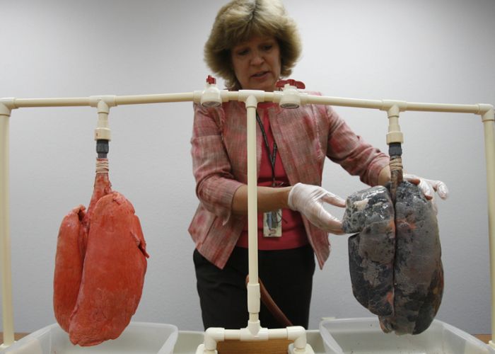 ΤΡΟΜΑΚΤΙΚΟ: δείτε τη διαφορά στους πνεύμονες ενός καπνιστή και ενός μη καπνιστή - Media