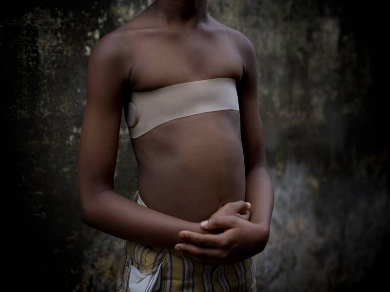 Μητέρες σιδερώνουν τα στήθη εφήβων κοριτσιών για να τα προστατεύσουν από τους βιασμούς (Video) - Media