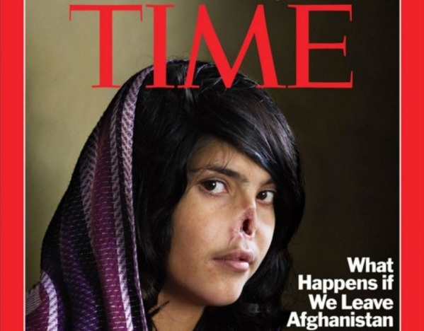 Αυτά είναι 10 από τα πιο πολυσυζητημένα και θαρραλέα εξώφυλλα (Photos) - Media