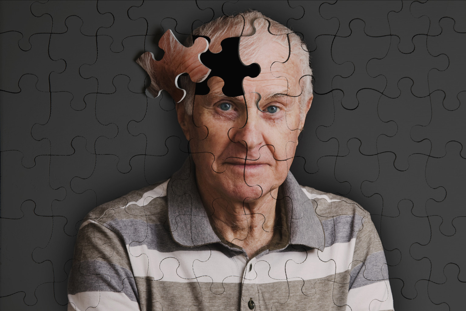 Αλτσχάιμερ: Ταχύτερη η εξέλιξη της νόσου όταν υπάρχει έντονο άγχος  - Media