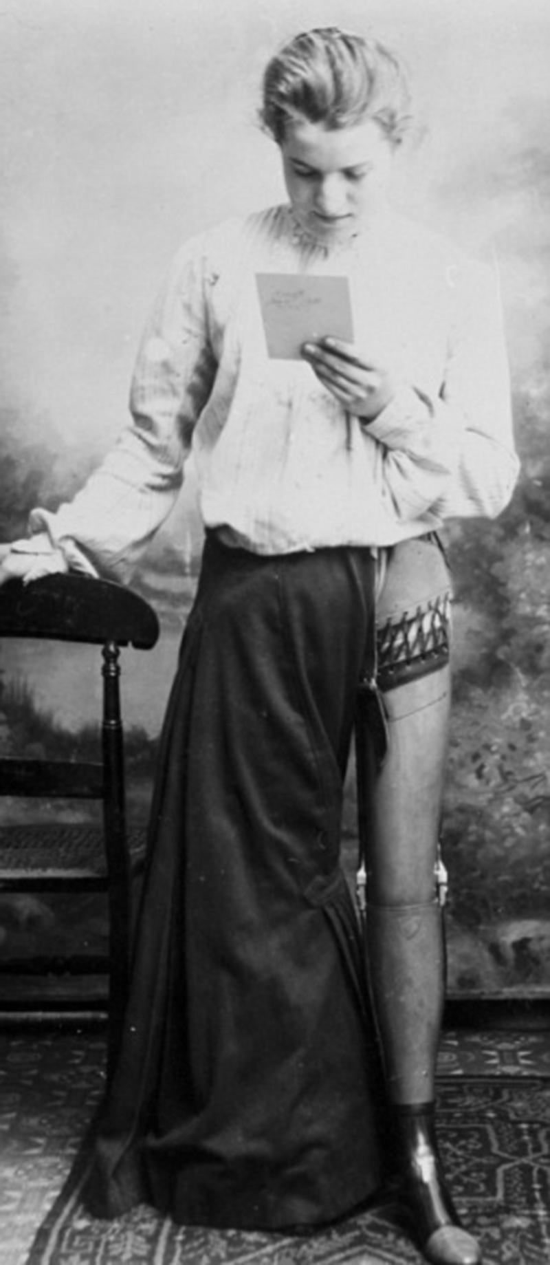 Μέλι: Πώς να το χρησιμοποιήσετε για να... απαλύνετε τον πόνο - Media