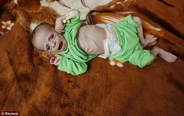 Σκληρές εικόνες: Στην Υεμένη τα παιδάκια πεθαίνουν από την πείνα  (Video &Photos) - Media