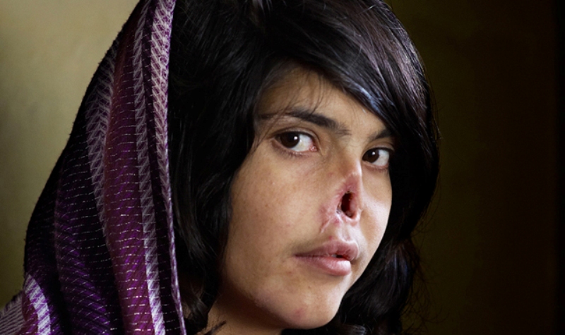 Ποιες είναι οι 5 πιο επικίνδυνες χώρες για να ζουν γυναίκες;  - Media