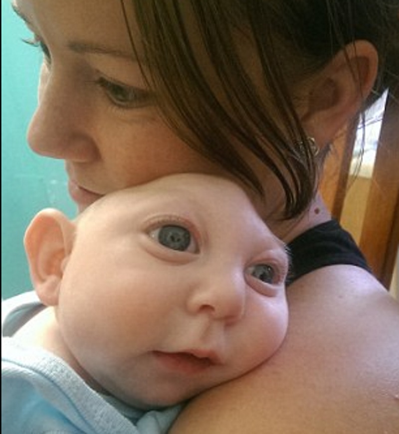 Και όμως γίνονται θαύματα: Το μωρό χωρίς κρανίο έγινε ενός έτους (Video & Photos) - Media