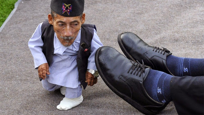 Πέθανε ο πιο κοντός άνθρωπος του κόσμου (Photos) - Media