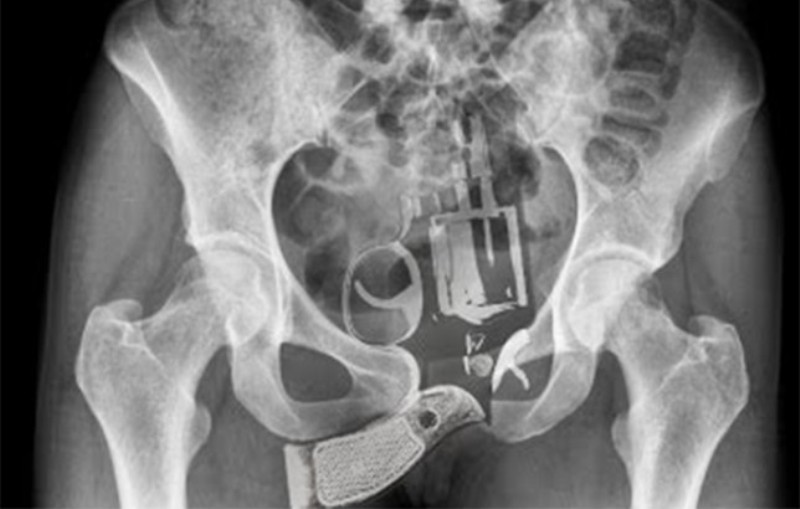 Έκρυψε στον κόλπο της ένα όπλο, αλλά φοβήθηκε μην εκπυρσοκροτήσει και… μαρτύρησε τον εαυτό της στους αστυνομικούς  - Media