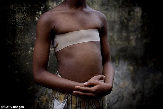 Αφρική: Εκατομμύρια γυναίκες αυτοακρωτηριάζονται για να μην πέσουν θύματα βιασμών (ΣΚΛΗΡΕΣ Photos) - Media