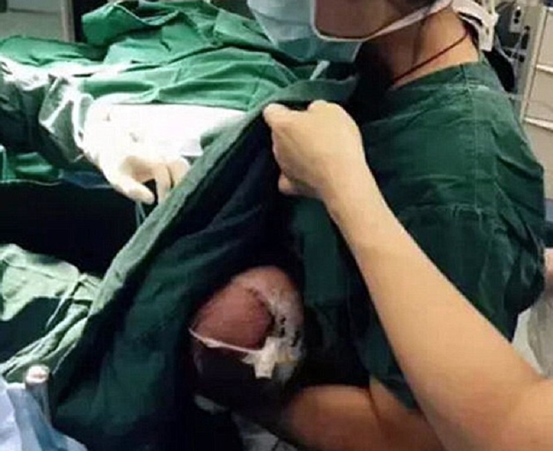 Νοσοκόμα θήλασε μωρό κατά την διάρκεια εγχείρισής του (Photos) - Media
