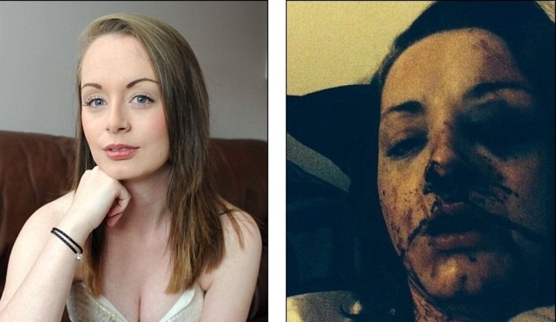 Τον έπιασε να την απατά, του ζήτησε το λόγο και εκείνος την άφησε δυο μέρες αναίσθητη από το ξύλο (Photos) - Media