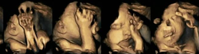 Απίστευτες φωτογραφίες: Τι προκαλεί στο έμβρυο το τσιγάρο της μητέρας (Photos) - Media