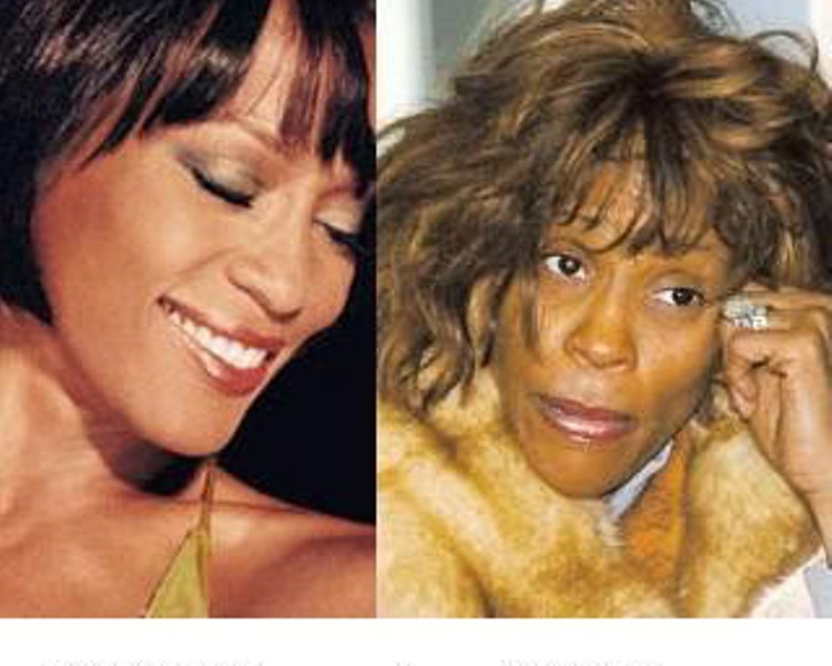 Δείτε πώς τα ναρκωτικά έκαναν πολλούς διάσημους να φαίνονται …σκιά του εαυτού τους (Photos) - Media