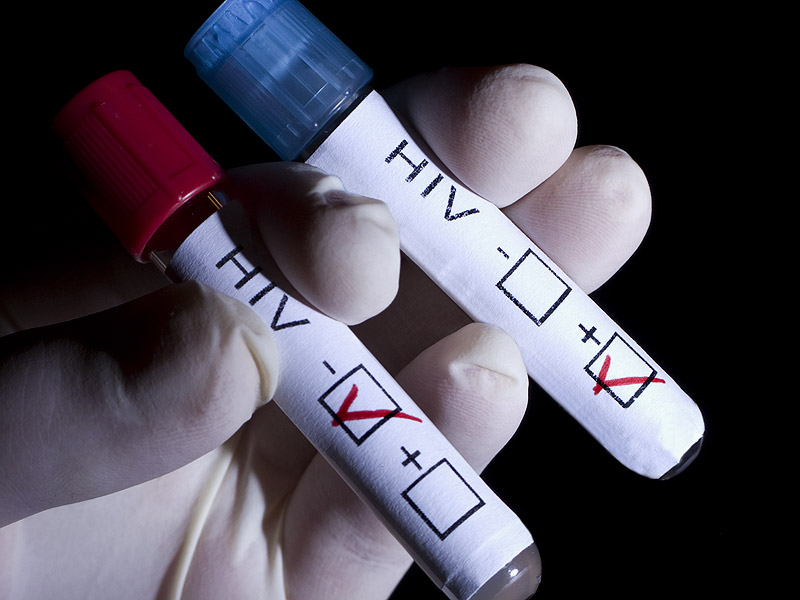 Ρεκόρ μολύνσεων από τον ιό HIV σε Ευρώπη και Ασία το 2014 - Media
