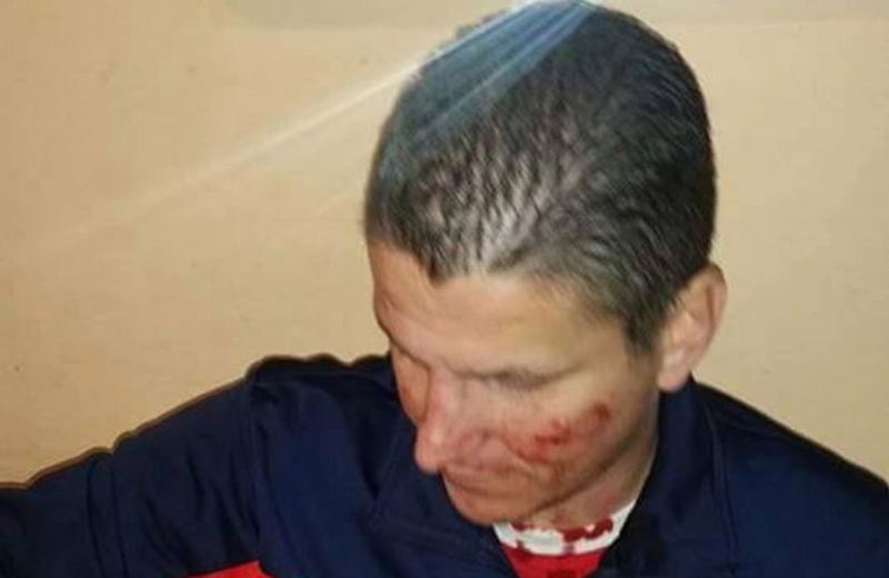 Σέρβοι οπαδοί μαχαιρώθηκαν στα Σκόπια από χούλιγκανς - Media