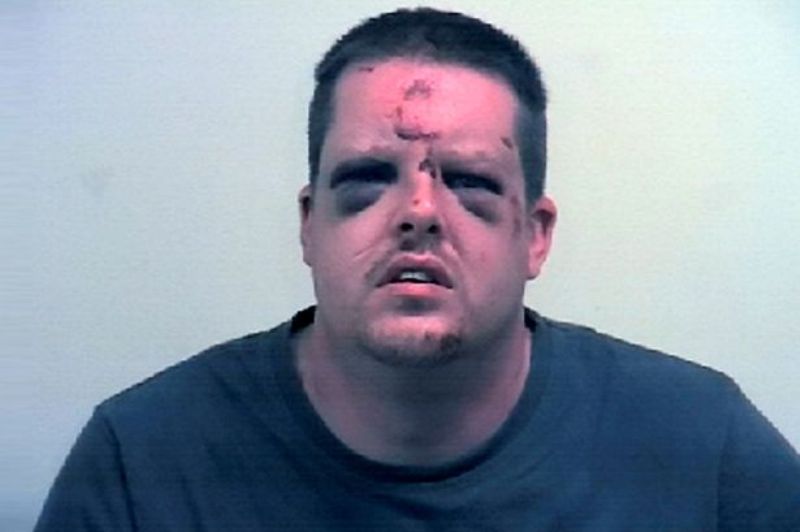 Προσπάθησε να τη βιάσει και «του έκανε τη μούρη κρέας» (Photos) - Media