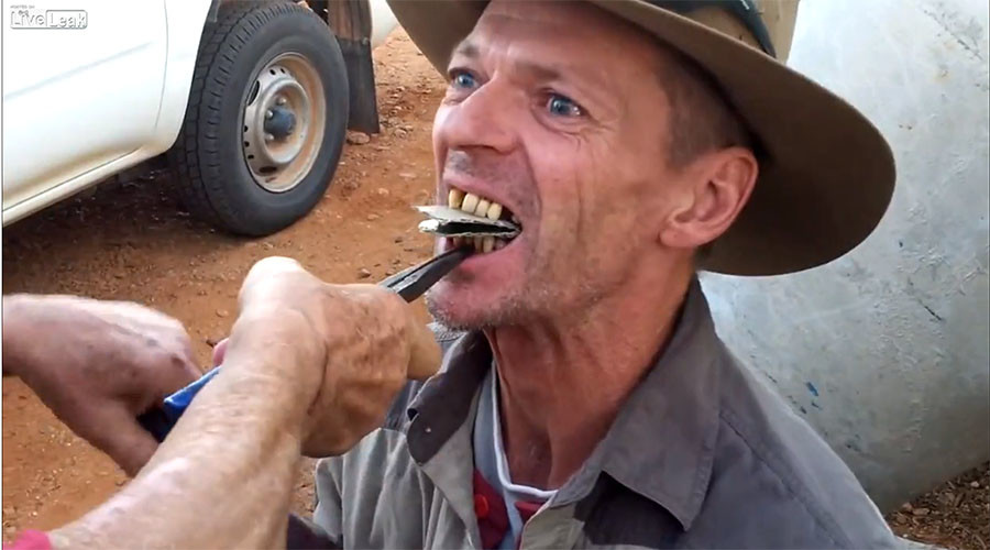 Εξαγωγή δοντιών με πένσα – «Οδοντιατρική» στην έρημο της Αυστραλίας (Video) - Media
