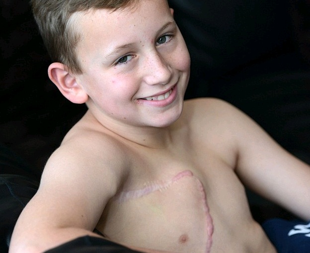 11χρονος έγινε ο νεαρότερος άνδρας που υπεβλήθη σε μαστεκτομή - Media