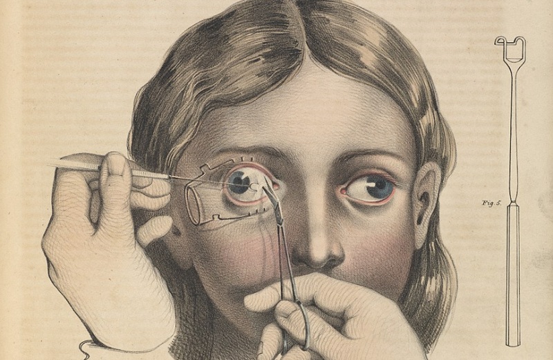 Δείτε πως χειρουργούσαν οι γιατροί τον 19ο αιώνα (photos) - Media