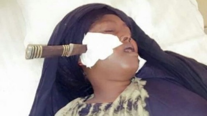 Κενυάτης μαχαίρωσε την γυναίκα του 10 φορές στο πρόσωπο-Κατακραυγή από οργανώσεις - Media