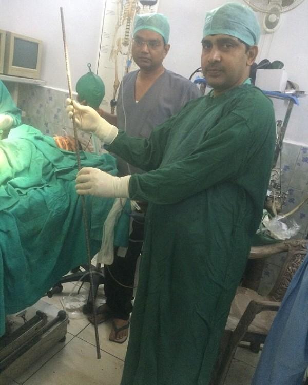 10χρονος έπεσε από στέγη και καρφώθηκε σε σιδερόβεργα – Είχε άγγελο και έζησε (σκληρές φωτογραφίες) - Media