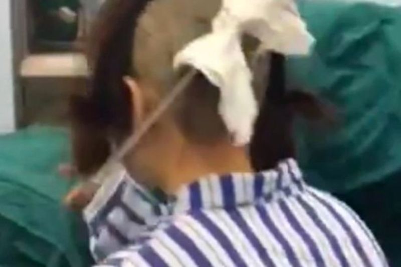 Η γυναίκα του ανακάλυψε ότι την απατούσε και τον χτύπησε με ένα μπαλτά στο κεφάλι (Video) - Media