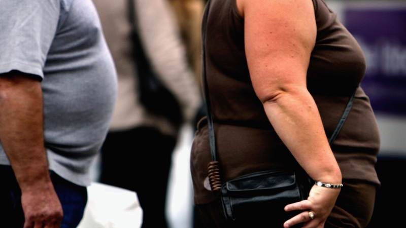 Η παχυσαρκία κόβει 10 χρόνια από τη ζωή - Οι άνδρες κινδυνεύουν περισσότερο - Media