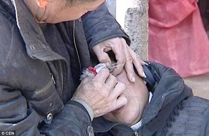 Η γυναίκα που όταν κλαίει αντί για δάκρυα βγάζει… πέτρες (Photos & Video) - Media