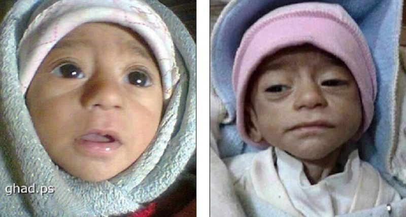 Το φριχτό πρόσωπο του πολέμου στη Συρία: Παιδιά πεθαίνουν από την πείνα σε πόλη που πολιορκεί ο ISIS (Photos)  - Media