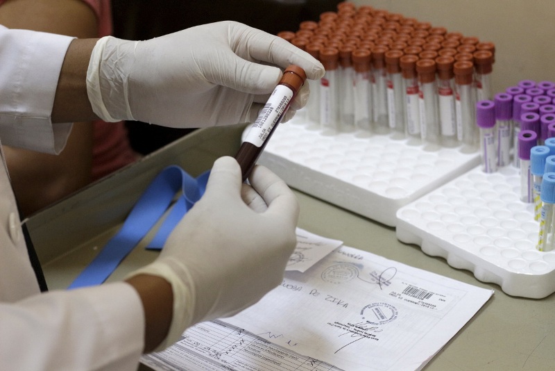 Ενδείξεις ότι ο ιός Ζίκα μπορεί να επιφέρει παράλυση - Media