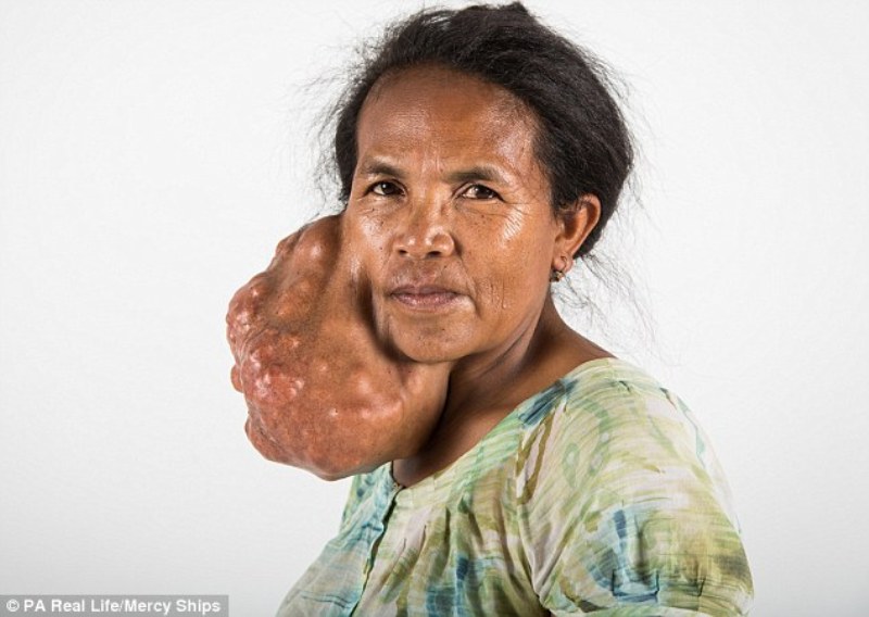 Δεν θα πιστεύετε τι κουβαλούσε στο πρόσωπό της για 14 χρόνια (Photos) - Media