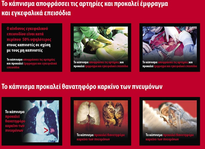 Αλλάζουν τα πακέτα των τσιγάρων - Θα έχουν αποκρουστικές εικόνες (Photos) - Media