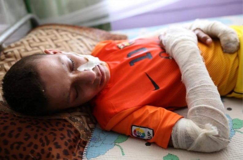 Αγόρι που τυφλώθηκε από επίθεση του ISIS βλέπει ξανά - Media