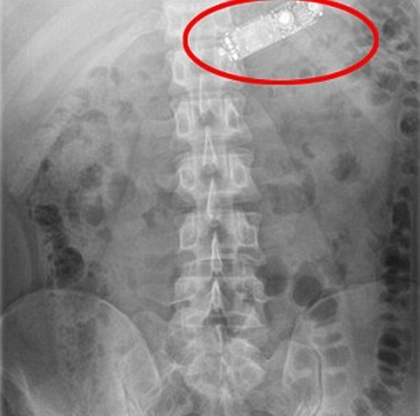 Φυλακισμένος κατάπιε το κινητό του (Photos) - Media