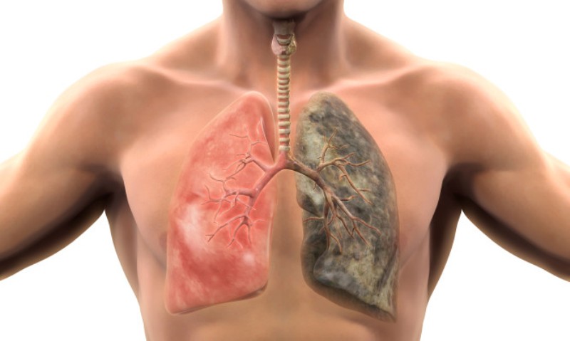 Πέντε σημάδια που αποκαλύπτουν ότι τα πνευμόνια σας κινδυνεύουν (Photos) - Media