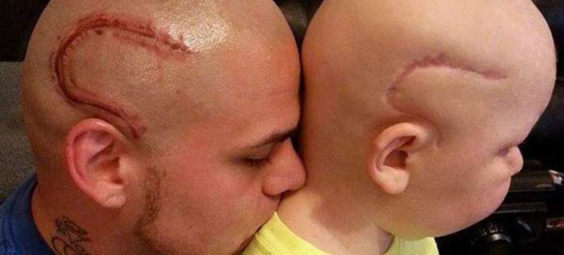 Πατέρας έκανε τατουάζ το σημάδι που έχει ο μικρός του γιος στο κορμί για να μη νιώθει άσχημα το παιδί (Photos) - Media
