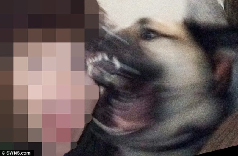 21 ράμματα σε 11χρονο αγόρι για μια selfie με σκύλο (Photos) - Media