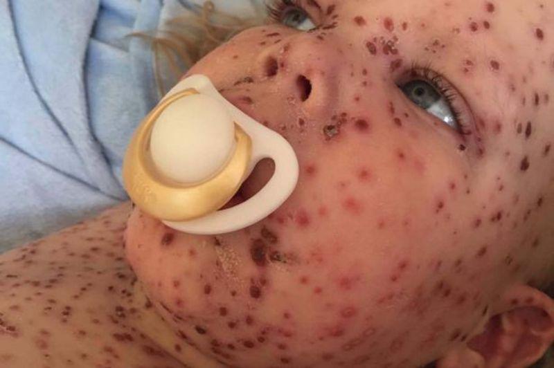 Δίχρονος πέρασε τη χειρότερη μορφή ανεμοβλογιάς (Photos)  - Media