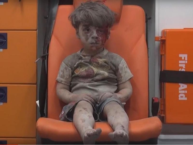 Σάλος με τις δηλώσεις Άσαντ: Η φωτογραφία του μικρού Ομράν είναι ψεύτικη ( Photo - Video) - Media