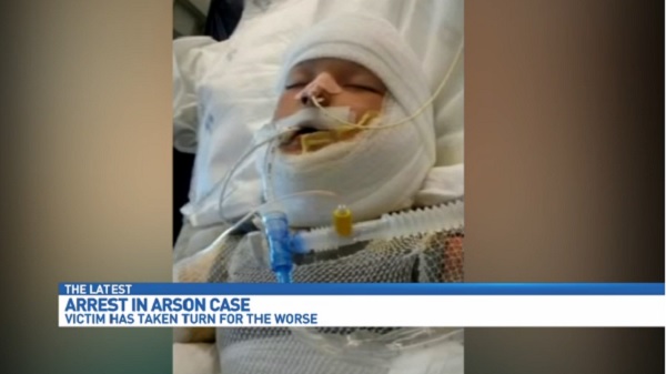 Φρίκη στις ΗΠΑ: Έλουσαν με βενζίνη και έκαψαν 10χρονο αυτιστικό αγόρι - Media