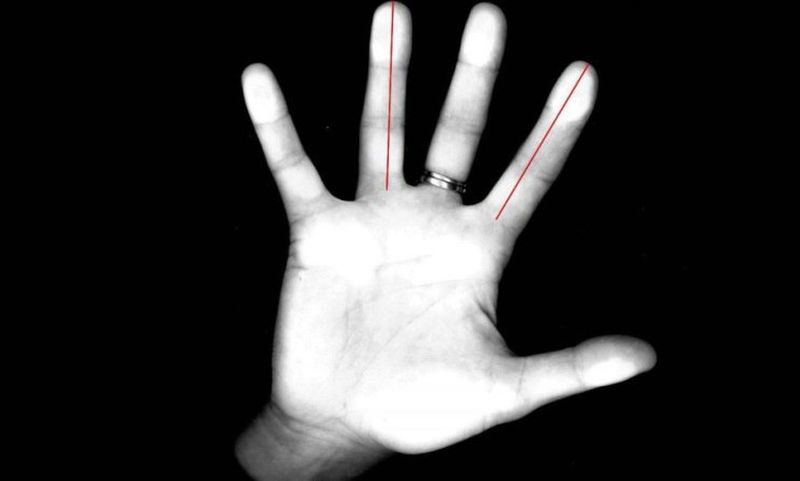 «Έχασε» τέσσερα δάχτυλα στη μηχανή του κιμά - Media