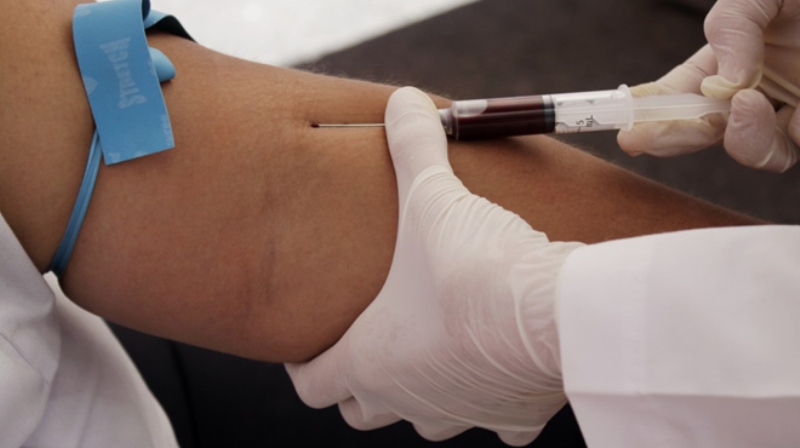 Εξέταση αίματος αποκαλύπτει την πραγματική μας ηλικία - Media