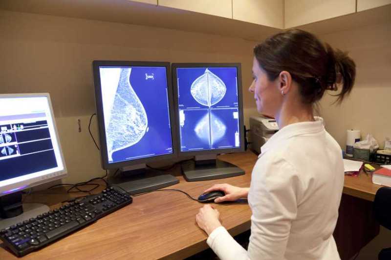 Πολάκης: Η ψηφιακή μαστογραφία θα συνταγογραφείται από τον ΕΟΠΥΥ - Media
