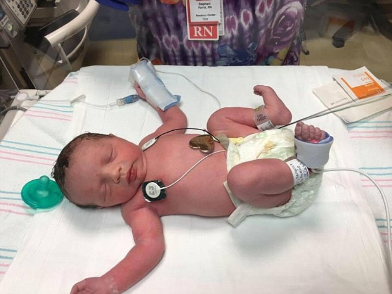 Ιατρικό θαύμα: Μωράκι γεννήθηκε δυο φορές  (Video) - Media