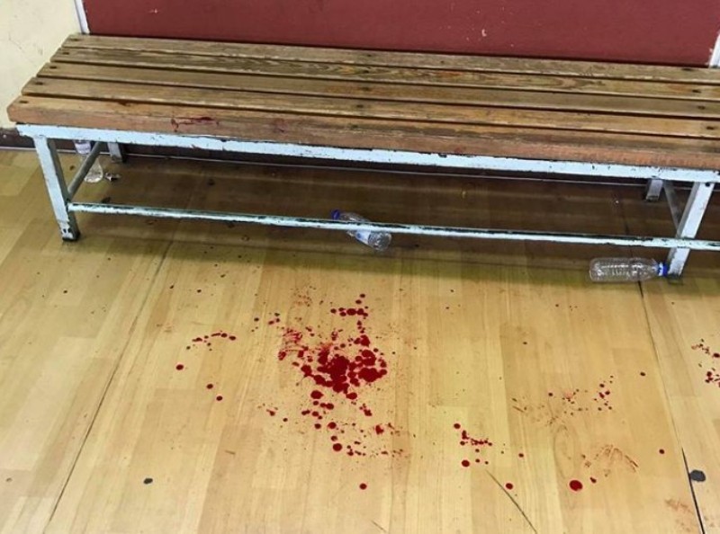 Επιτέθηκαν με σιδερογροθιά στον προπονητή του Παναιγινιακού, κατά τη διάρκεια του αγώνα  - Media