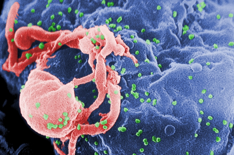 Γιατί δεν έχει ακόμα βρεθεί εμβόλιο για τον ιό του AIDS; - Media