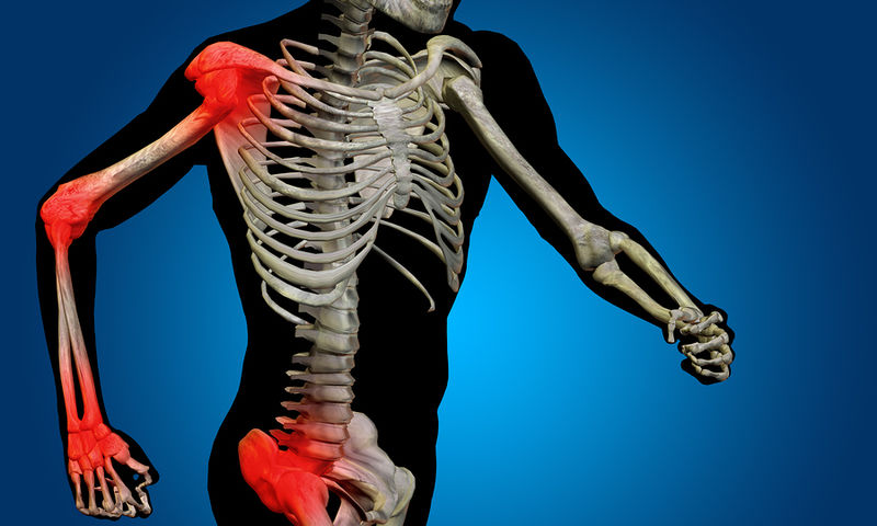 Υγεία οστών: 4 σημάδια που δείχνουν ότι κινδυνεύετε - Media