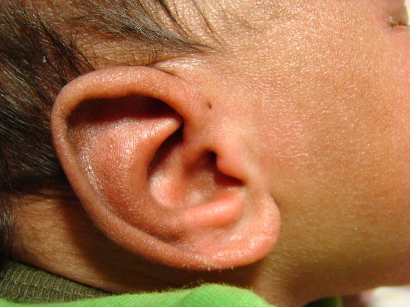 Τι είναι η μικρή τρύπα που πολλοί άνθρωποι έχουν στο αυτί τους; (Photos) - Media